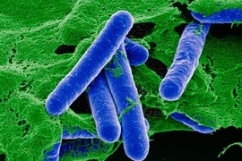 Bộ Y tế cấp phép nhập khẩu thuốc giải độc ngộ độc thực phẩm hiếm gặp