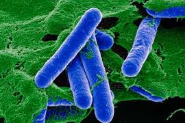 Bộ Y tế cấp phép nhập khẩu thuốc giải độc ngộ độc thực phẩm hiếm gặp