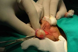 Chức năng nội tiết và ngoại tiết của tinh hoàn