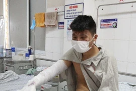 Bỏng nặng do bình gas mini phát nổ