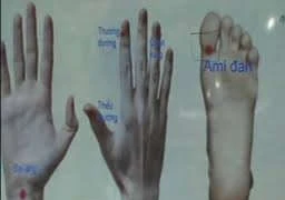 Bấm huyệt trị viêm amiđan