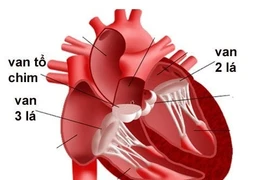 Ngại xây dựng gia đình vì mắc bệnh tim