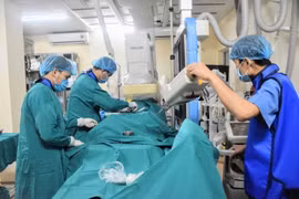 Lò xo kim loại nút phình động mạch não