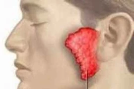 Sưng đau tinh hoàn đề nghị trữ tinh trùng