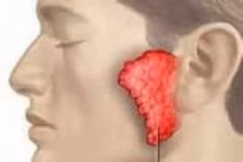 Sưng đau tinh hoàn đề nghị trữ tinh trùng