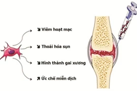 Tế bào gốc tủy xương chữa đau xương khớp
