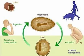 Viêm cơ tim cấp do trùng lông