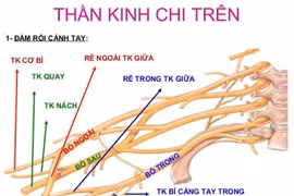 Con liệt tay vì được quăng đùa
