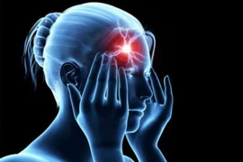 Cách ngăn ngừa đột quỵ não tái phát hiệu quả nhờ sản phẩm thiên nhiên