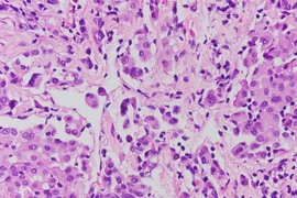 Hạn chế tiếp xúc với các vật liệu chứa amiăng