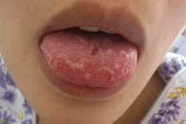 Biểu hiện bệnh qua dấu hiệu bất thường của cơ thể