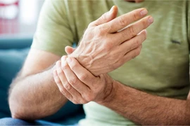 Chữa bệnh gút ở cổ tay nhờ thảo dược - Hướng đi mới mang tới hiệu quả bất ngờ