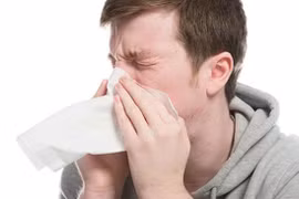 Bồ kết trị viêm mũi dị ứng