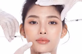 Không lạm dụng tiêm botox quá sớm 