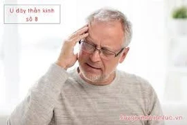 Điếc do u nằm trong ống tai