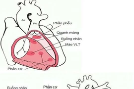 Chẩn đoán trước sinh phát hiện bệnh thông liên thất