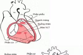 Chẩn đoán trước sinh phát hiện bệnh thông liên thất