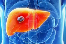 6 bệnh ung thư người béo phì dễ mắc