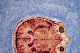 Người đầu tiên tình nguyện hiến xác theo “kỹ thuật số”