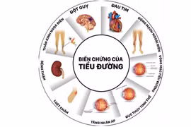 Biến chứng cấp và mạn tính trong đái tháo đường