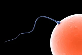  Mẫu tinh trùng có thể giúp dự đoán nguy cơ tự kỷ ở trẻ em