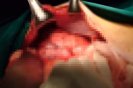 Tự chẩn đoán, tự điều trị 