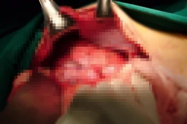 Tự chẩn đoán, tự điều trị 