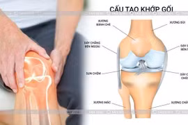  Đau khớp nên sợ vận động