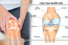  Đau khớp nên sợ vận động