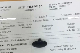 Chủ quan con hóc dị vật nguy hiểm