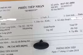 Chủ quan con hóc dị vật nguy hiểm