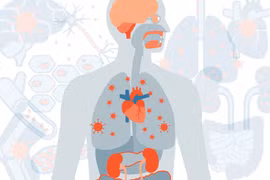 Những rủi ro sức khỏe hậu Covid-19 