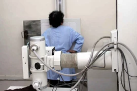 Khỏi ung thư vú vô tình phát hiện u phổi