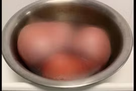 Phẫu thuật khối u xơ tử cung “khủng” 