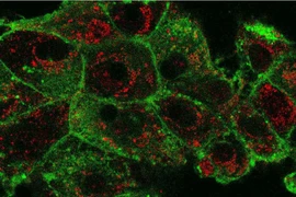 Công nghệ nano giúp điều trị ung thư hiệu quả hơn