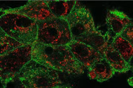 Công nghệ nano giúp điều trị ung thư hiệu quả hơn