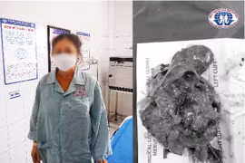 Sốc mất máu do vỡ u thận sau tập thể dục