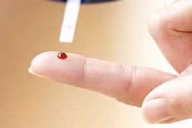 Chích máu đầu ngón tay điều trị đột quỵ chỉ là trò lừa bịp