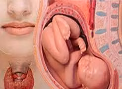 Tưởng trầm cảm sau sinh nào ngờ viêm tuyến giáp.