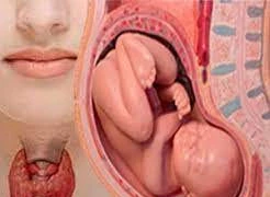 Tưởng trầm cảm sau sinh nào ngờ viêm tuyến giáp.