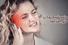 Tai ù, nghe kém khi sử dụng kháng sinh