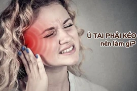 Tai ù, nghe kém khi sử dụng kháng sinh