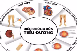 Tử vong đột ngột ở người cao tuổi mắc đái tháo đường