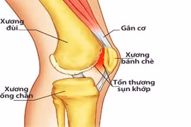  Tháo khớp và thay khớp
