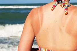 Khắc phục cháy nắng bằng vật liệu tự làm