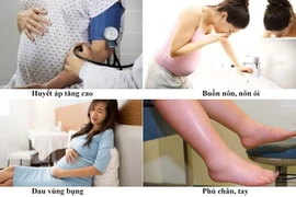 Sàng lọc, điều trị dự phòng tiền sản giật