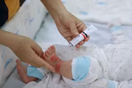 Chăm sóc đúng cách trẻ mắc viêm da cơ địa