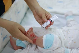 Chăm sóc đúng cách trẻ mắc viêm da cơ địa