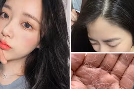 Cách giảm tóc bạc tại nhà an toàn