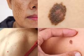 5 bước chăm sóc da cơ bản, ai cũng nên biết